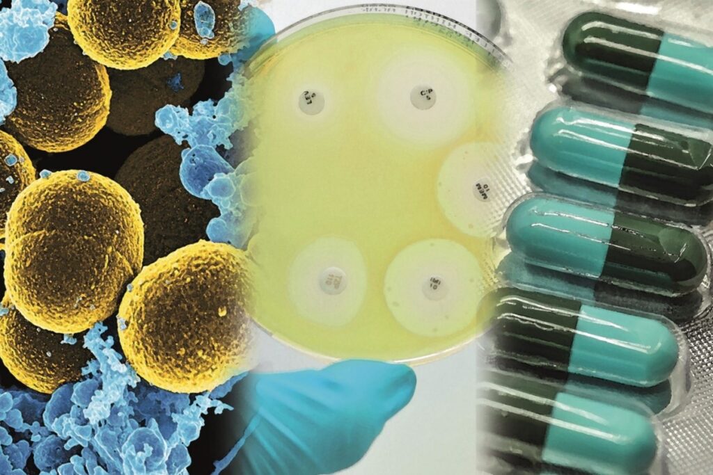 Innovation in Antibacterial Treatments: After COVID, Are We Ready to Fight the Bacteria?